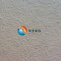 人星形胶质细胞-永生化