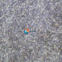 人胰腺癌相关成纤维细胞永生化 