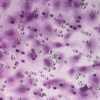 细胞迁移transwell