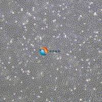 人骨骼肌成肌细胞-永生化