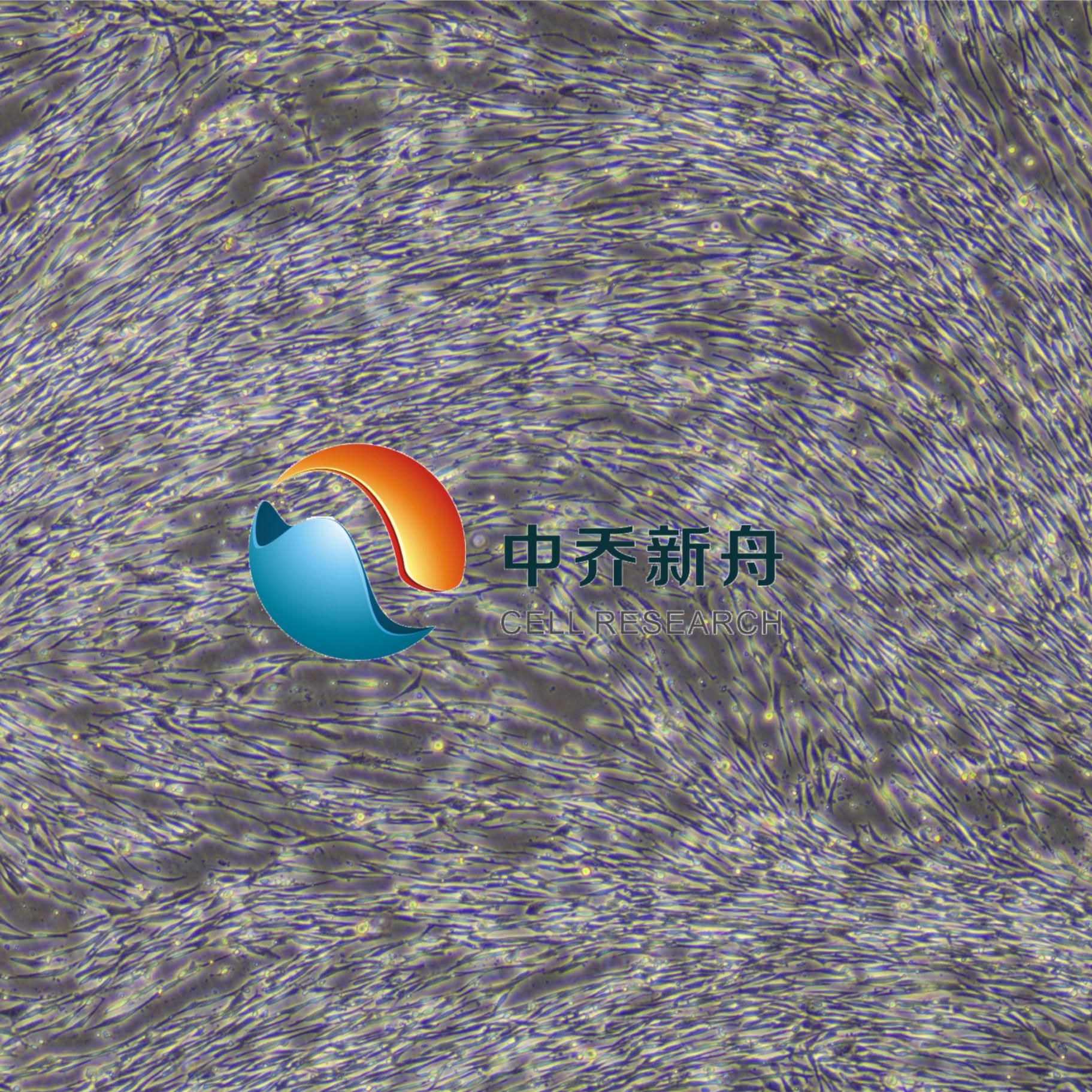 人间充质干细胞--脂肪-永生化