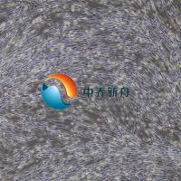 人间充质干细胞--脂肪-永生化