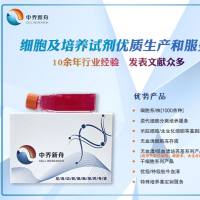 人卵巢肿瘤组织成纤维细胞永生化 