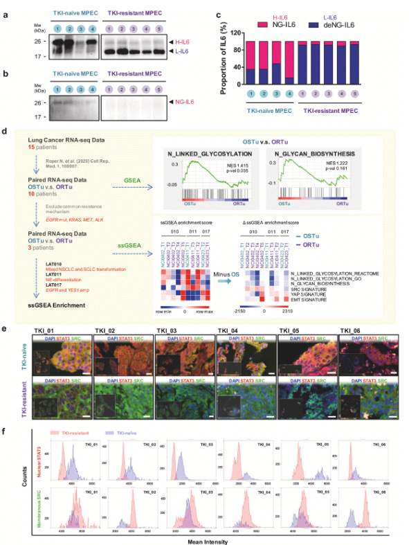 image.png 国立成功大学团队揭示糖基化缺陷的IL-6调控肺癌进展及耐药的新机制