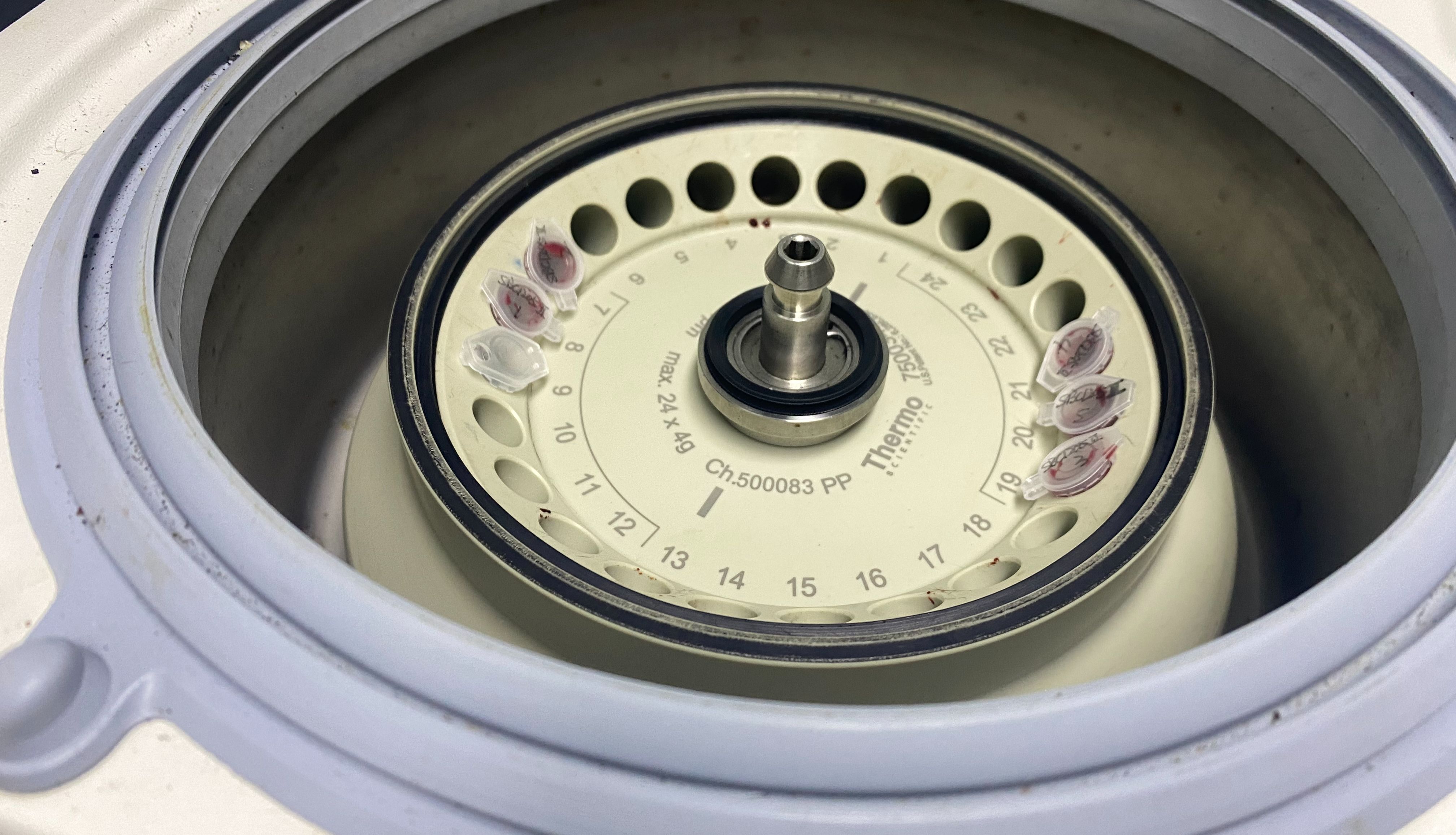 检测实验丨外泌体提取操作方法，带你一文了解