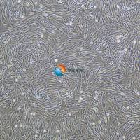 人真皮成纤维细胞永生化(新生儿)