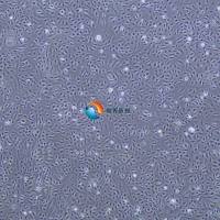 小鼠肺动脉内皮细胞-永生化 