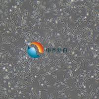 人髓核细胞永生化