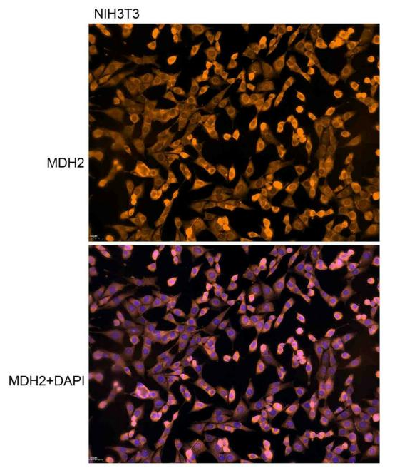 抗體產(chǎn)品星推薦第二十四期lAnti-MDH2 Polyclonal Antibody