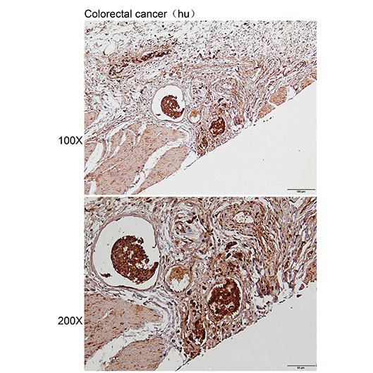 抗體產(chǎn)品星推薦第二十四期lAnti-MDH2 Polyclonal Antibody