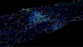 CD44与CD62L对肿瘤细胞和T细胞的标记意义
