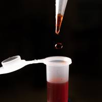 人血浆纤溶酶原