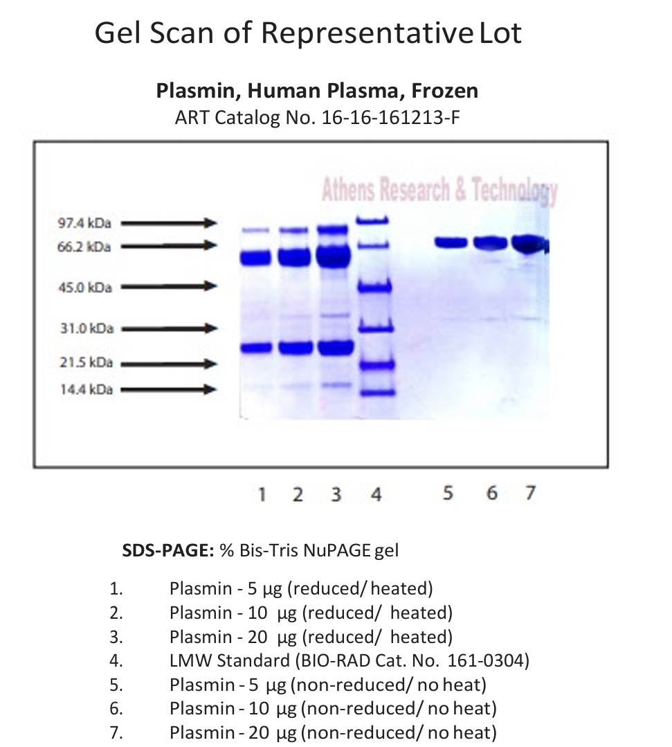 人血浆纤溶酶（冻存/冻干）