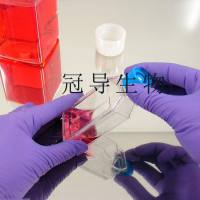 Saos-2人成骨肉瘤传代细胞|送STR图谱