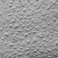 人前列腺微血管内皮细胞