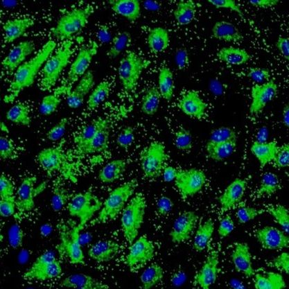 人肝窦内皮细胞