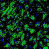 人肝窦内皮细胞