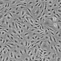 人精囊微血管内皮细胞(Sciencell进口)