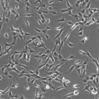 人气管成纤维细胞
