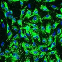 人冠状动脉内皮细胞