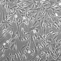 人膀胱平滑肌细胞 HBdSMC (Sciencell进口)