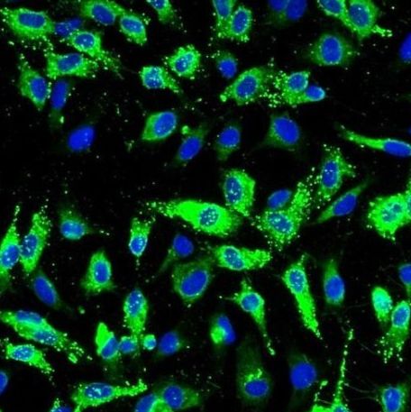 人肺动脉内皮细胞