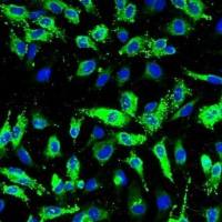 人肺动脉内皮细胞