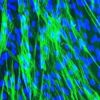 人气管平滑肌细胞