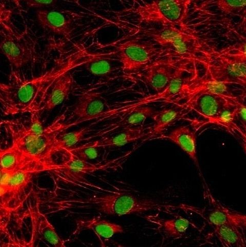 人肺成纤维细胞-成人