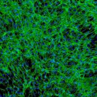 人胰腺星状细胞