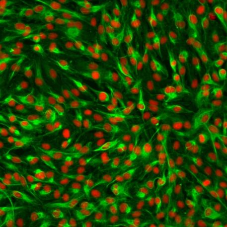 人肝内胆管上皮细胞