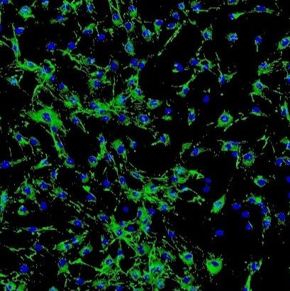 人眼脉络膜成纤维细胞