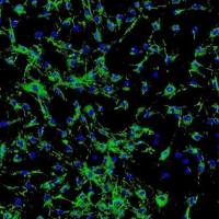 人眼脉络膜成纤维细胞