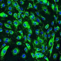 人真皮淋巴管内皮细胞