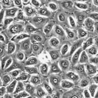 人口腔角质细胞