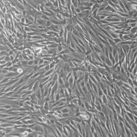 人前列腺成纤维细胞