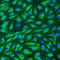 人淋巴内皮细胞