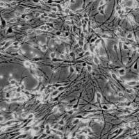 人海马趾神经元