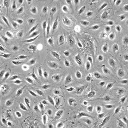 人膀胱微血管内皮细胞 HBdMEC（Sciencell进口）