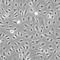 人膀胱微血管内皮细胞