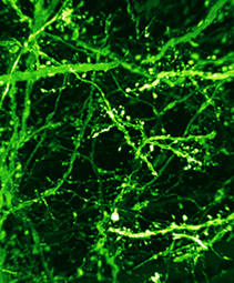 深层组织的高分辨率·高亮度分析  SeeDB2