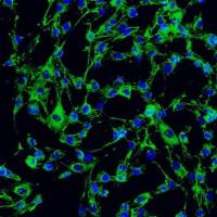 人食管成纤维细胞