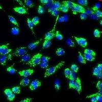 人主动脉内皮细胞