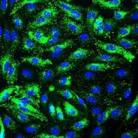 人脾血管内皮细胞