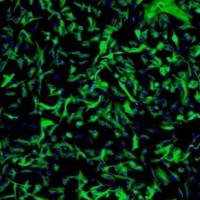 人小脑星形胶质细胞