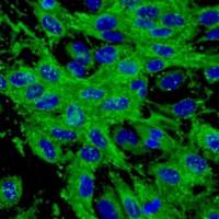 人真皮微血管内皮细胞