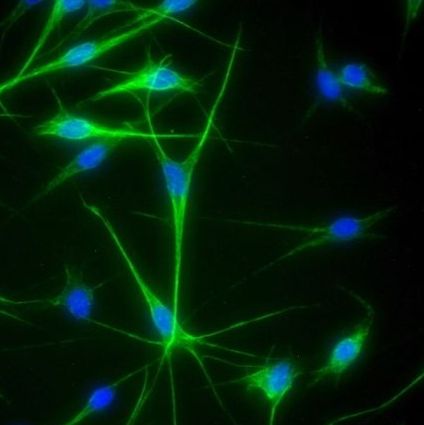 人表皮黑色素细胞-中色素HEM-m (Sciencell进口)