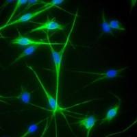 人表皮黑色素细胞-中色素HEM-m (Sciencell进口)