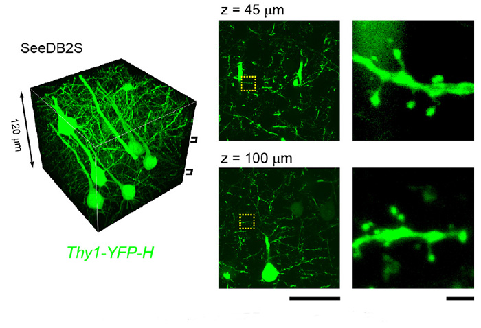 深层组织的高分辨率·高亮度分析  SeeDB2