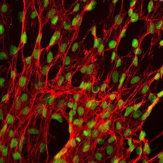 人脾成纤维细胞